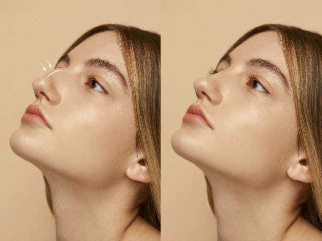 harmony-rhinoplasty